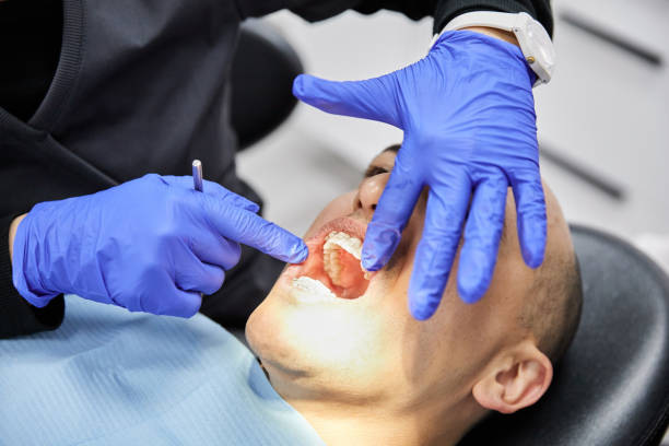 Best Emergency Dental Care for Abscessed Tooth in Reno, OH
